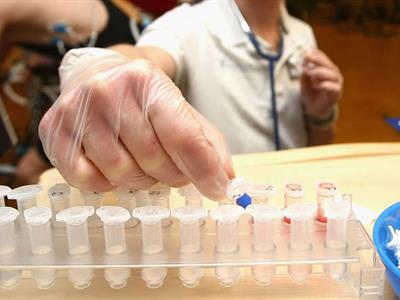 El monóxido de carbono en la lista de sustancias y métodos prohibidas